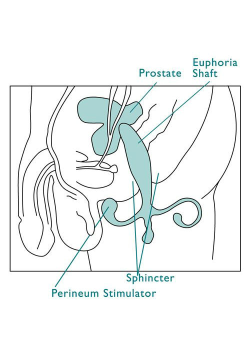 Prostimulator Prostimulator